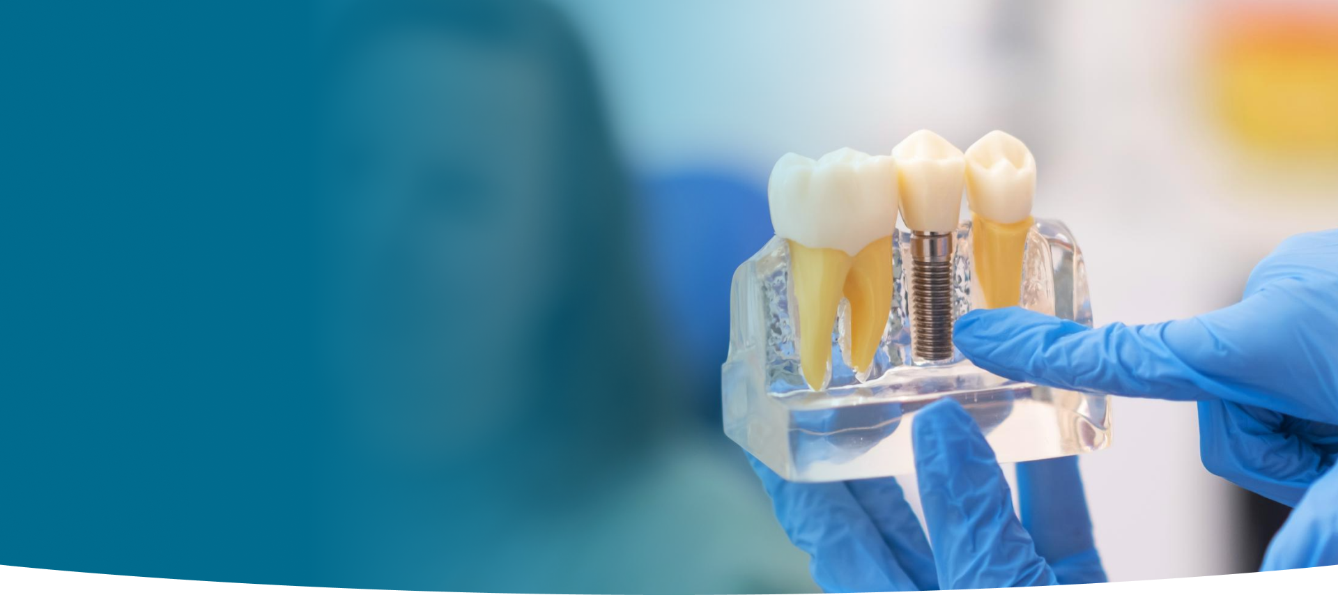 Dental Implants at World Dental Specialities