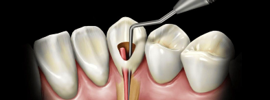 Endodontics