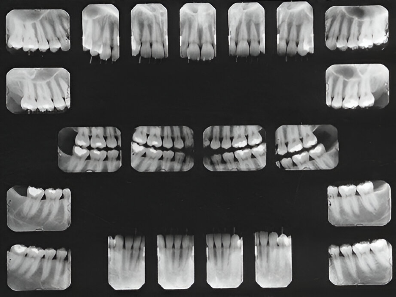 X-rays