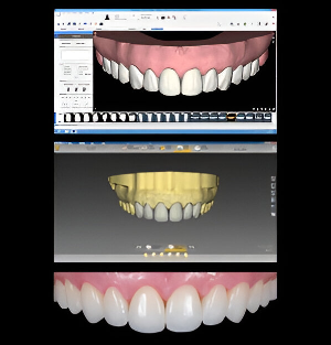 Cosmetic Dentistry