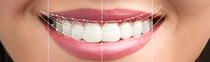 Cosmetic Dentistry