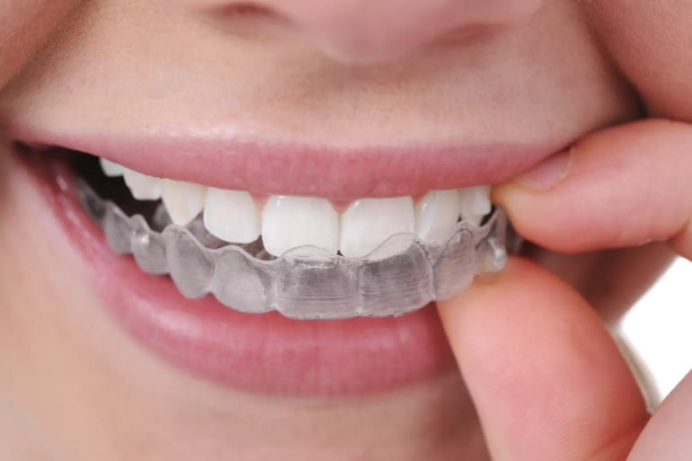 Dental Invisalign