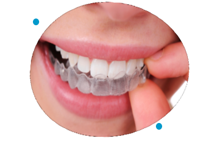 invisalign-braces-dentist