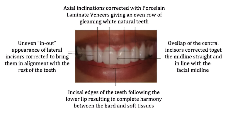 Smile Analysis