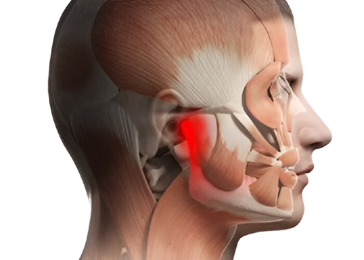 tmj disorder