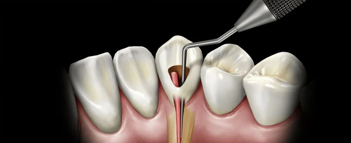 ENDODONTICS