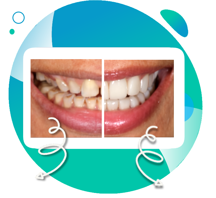 Full mouth rehabilitation services Mumbai